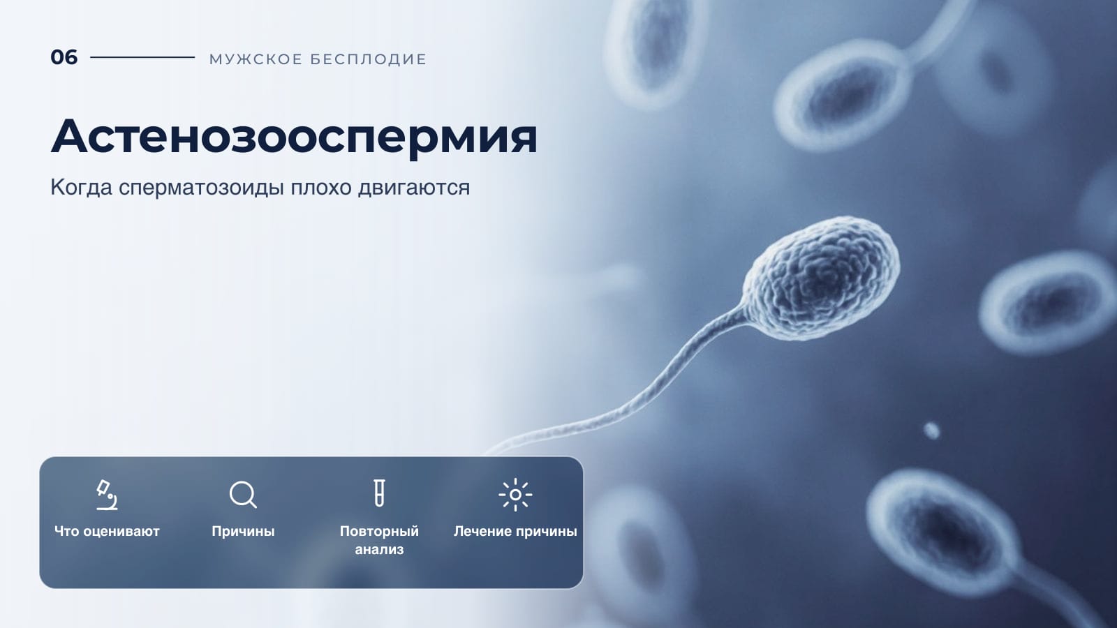Астенозооспермия: когда сперматозоиды плохо двигаются