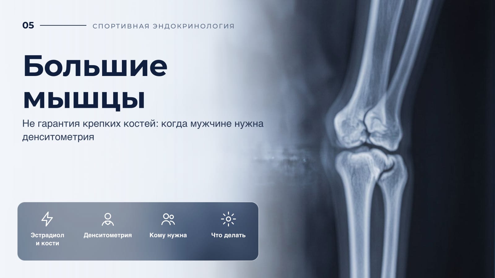 Большие мышцы - не гарантия крепких костей: когда мужчине нужна денситометрия