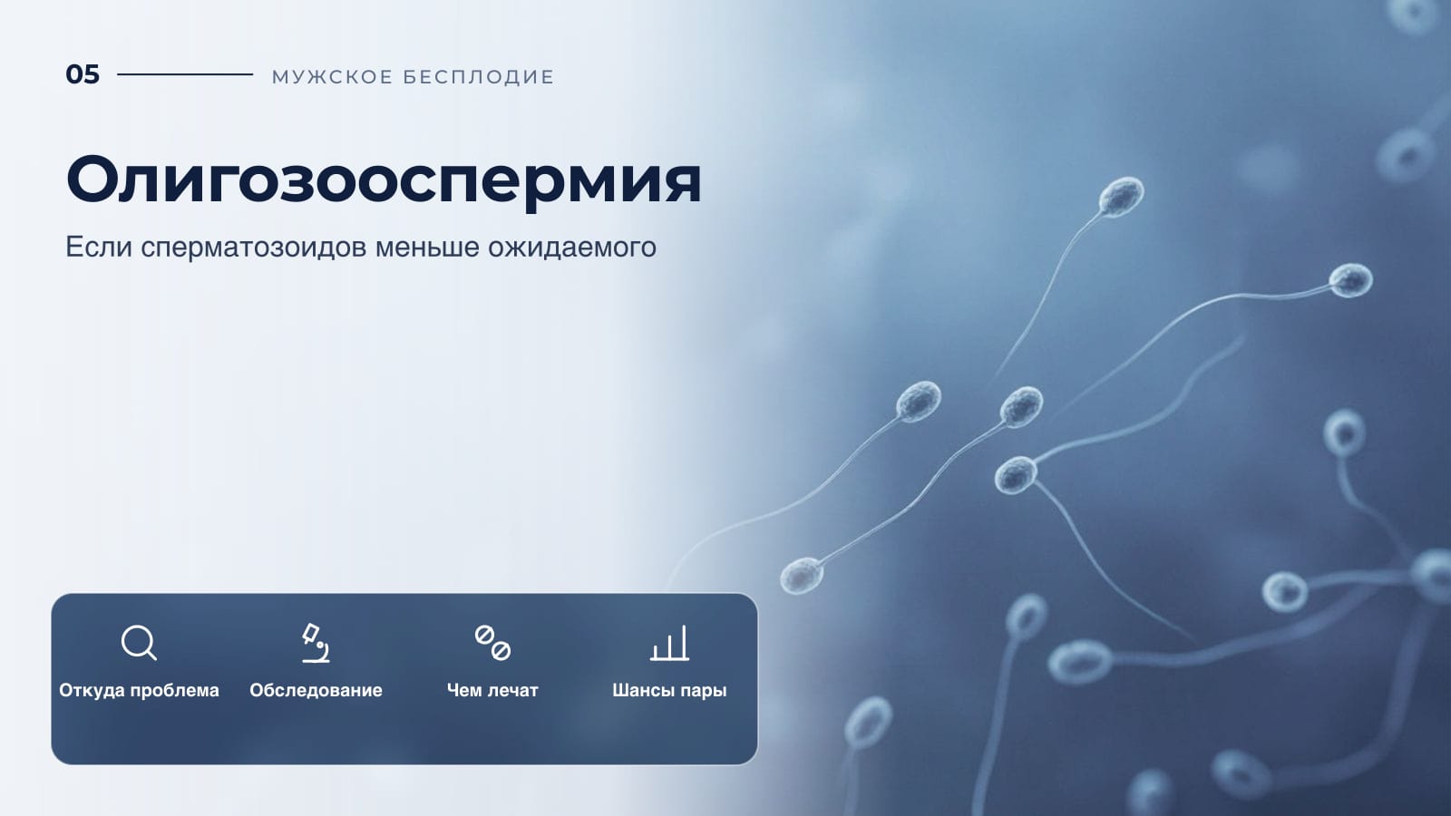 Олигозооспермия: если сперматозоидов меньше ожидаемого