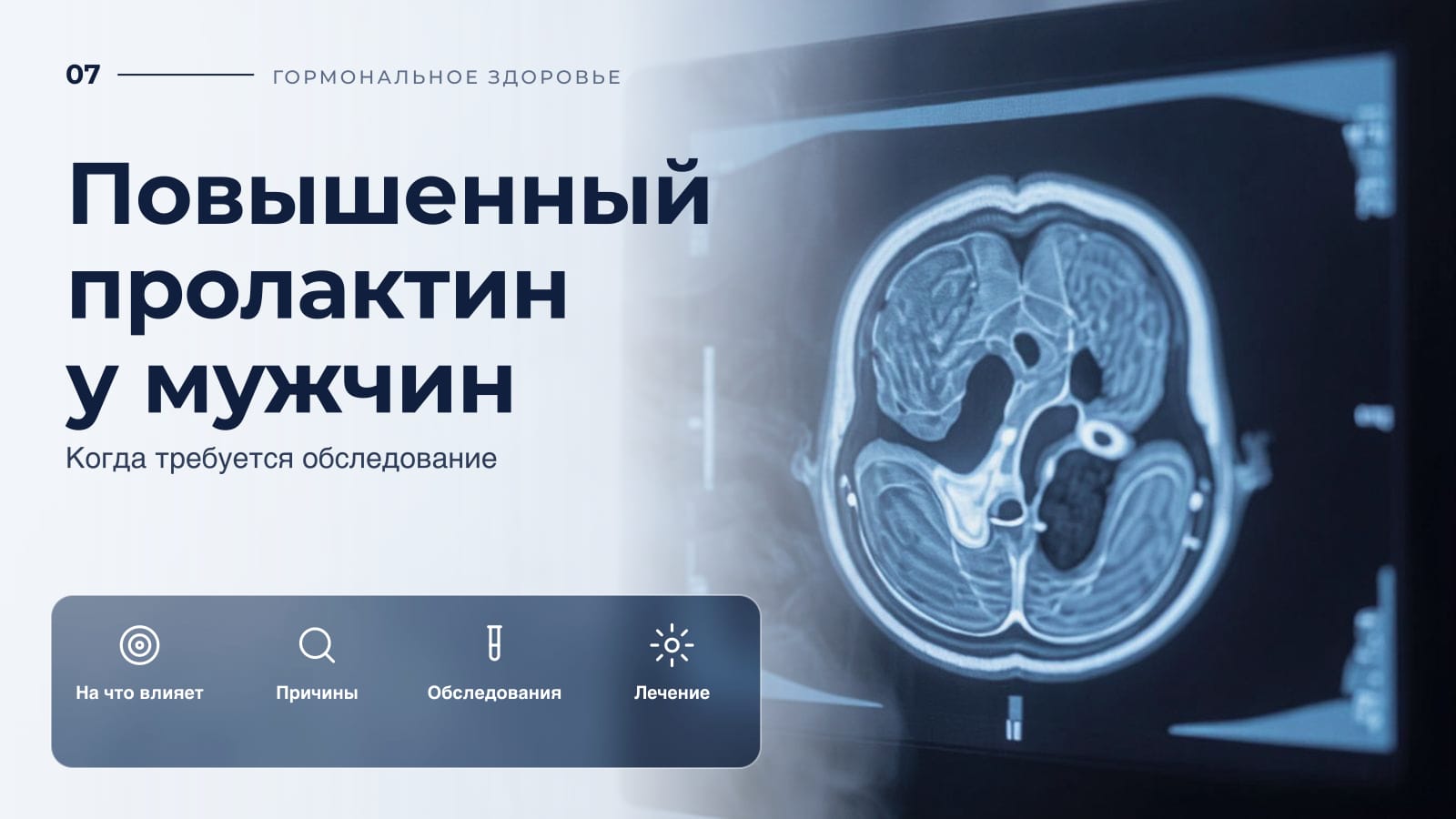 Повышенный пролактин у мужчин: когда требуется обследование