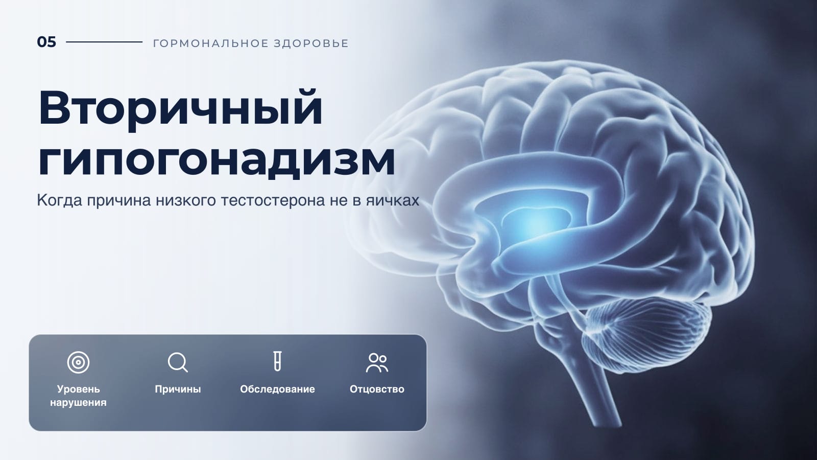 Вторичный гипогонадизм: когда причина низкого тестостерона не в яичках